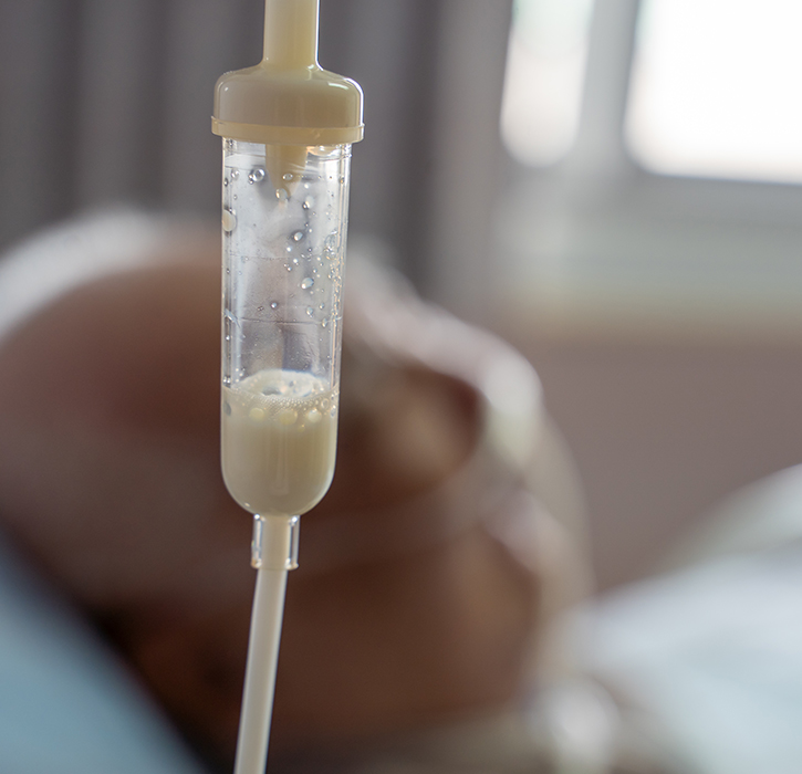 parenteral nutrition